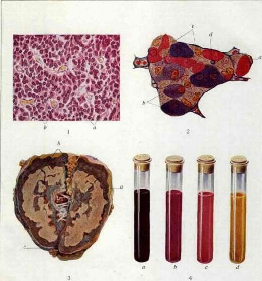 Pituitary Gland: figure 2 from the 1928–1936 encyclopedia article
