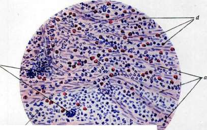 Inflammation: figure 3 from the 1928–1936 encyclopedia article