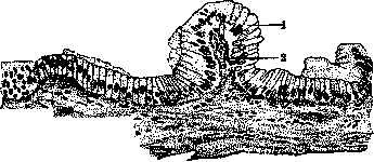 Gallbladder: figure 35 from the 1928–1936 encyclopedia article