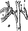 Gallbladder: figure 26 from the 1928–1936 encyclopedia article