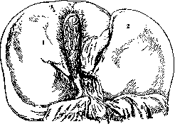 Gallbladder: figure 11 from the 1928–1936 encyclopedia article