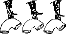 Gallbladder: figure 19 from the 1928–1936 encyclopedia article