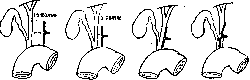 Gallbladder: figure 20 from the 1928–1936 encyclopedia article