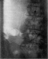 Gallbladder: figure 38 from the 1928–1936 encyclopedia article