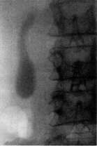 Gallbladder: figure 39 from the 1928–1936 encyclopedia article
