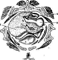 Parametritis: figure 1 from the 1928–1936 encyclopedia article