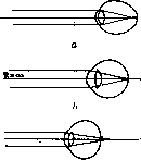 Refraction: figure 1 from the 1928–1936 encyclopedia article