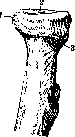 Elbow Joint: figure 3 from the 1928–1936 encyclopedia article