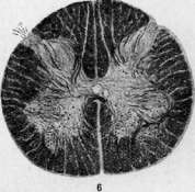 Spinelli: figure 31 from the 1928–1936 encyclopedia article