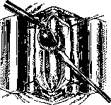 Spinelli: figure 45 from the 1928–1936 encyclopedia article