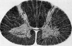 Spinelli: figure 28 from the 1928–1936 encyclopedia article