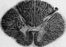 Spinelli: figure 29 from the 1928–1936 encyclopedia article