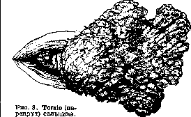 Omentum: figure 8 from the 1928–1936 encyclopedia article