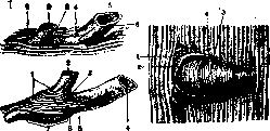 Sphincter of Oddi: figure 1 from the 1928–1936 encyclopedia article