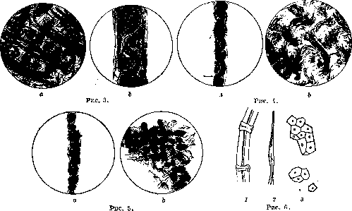 Sphincter of Oddi: figure 3 from the 1928–1936 encyclopedia article