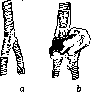 Sex: figure 4 from the 1928–1936 encyclopedia article