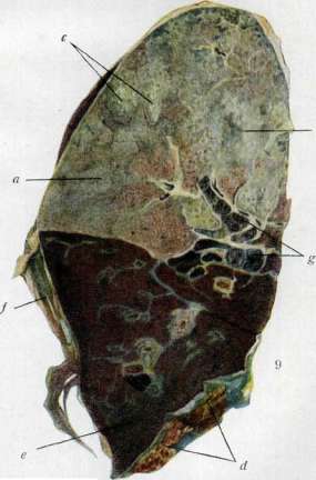 Sex: figure 10 from the 1928–1936 encyclopedia article