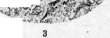Pneumonia: figure 7 from the 1928–1936 encyclopedia article