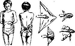 Desmurgy: figure 3 from the 1928–1936 encyclopedia article