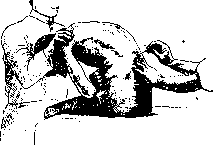 Lumbar Puncture: figure 2 from the 1928–1936 encyclopedia article