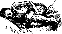 Vesiculitis: figure 3 from the 1928–1936 encyclopedia article