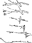 Microsurgery: figure 14 from the 1928–1936 encyclopedia article