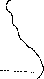 Heart Defects: figure 8 from the 1928–1936 encyclopedia article