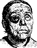Amyloid of the Eye: figure 1 from the 1928–1936 encyclopedia article