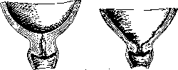 Childbirth: figure 2 from the 1928–1936 encyclopedia article