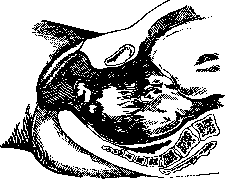Breech Presentation: figure 15 from the 1928–1936 encyclopedia article