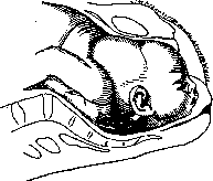 Childbirth: figure 20 from the 1928–1936 encyclopedia article