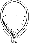 Breech Presentation: figure 9 from the 1928–1936 encyclopedia article