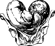 Breech Presentation: figure 35 from the 1928–1936 encyclopedia article