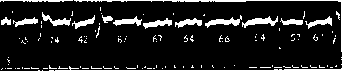 Cardiac Arrhythmias: figure 8 from the 1928–1936 encyclopedia article