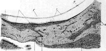 Labyrinthitis: figure 1 from the 1928–1936 encyclopedia article