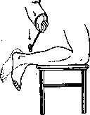 Alessandro Achillini: figure 1 from the 1928–1936 encyclopedia article