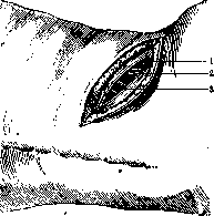 Lumbar Region: figure 4 from the 1928–1936 encyclopedia article