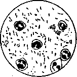 Bacteriuria: figure 2 from the 1928–1936 encyclopedia article