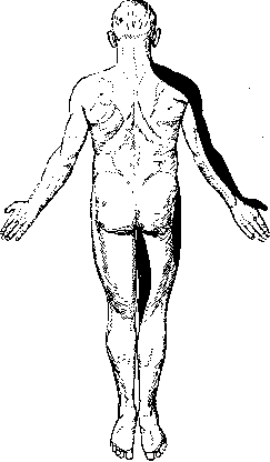 Radiculitis: figure 2 from the 1928–1936 encyclopedia article
