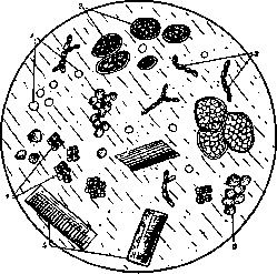 Gastritis: figure 4 from the 1928–1936 encyclopedia article