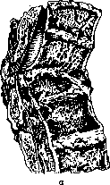 Spine: figure 38 from the 1928–1936 encyclopedia article