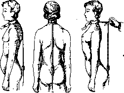 Spine: figure 25 from the 1928–1936 encyclopedia article