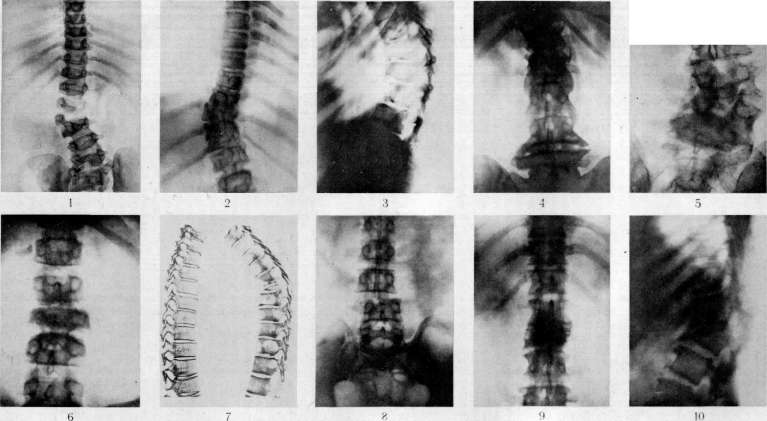 Spine: figure 32 from the 1928–1936 encyclopedia article