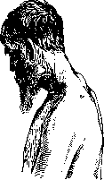 Spine: figure 35 from the 1928–1936 encyclopedia article