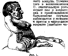 Osteomalacia: figure 1 from the 1928–1936 encyclopedia article