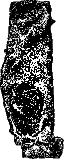 Arteriosclerosis: figure 1 from the 1928–1936 encyclopedia article