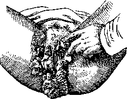 Vegetations: figure 1 from the 1928–1936 encyclopedia article