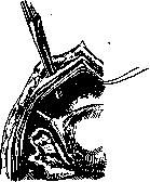 Gilliam-Doleris Operation: figure 1 from the 1928–1936 encyclopedia article