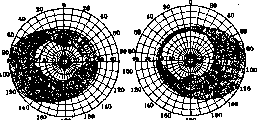 Multiple Sclerosis: figure 4 from the 1928–1936 encyclopedia article
