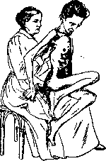 Multiple Sclerosis: figure 5 from the 1928–1936 encyclopedia article